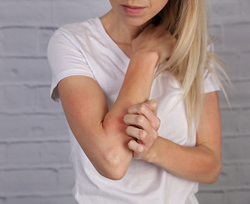 Eczema & Skin Allergies